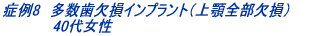 症例3 インプラント単独歯(左上3番) 53歳女性 治療期間6ヶ月