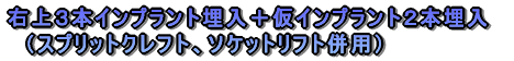 �e�m�炸�̈ڐA�Ʋ�����ĂR�{����