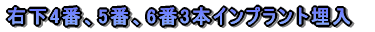 em炸̈ڐAƲĂR{