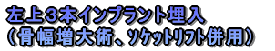 �e�m�炸�̈ڐA�Ʋ�����ĂR�{����